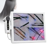 ELIKBH Telecamera per Il Cuoio capelluto da 15 Pollici con Funzione microscopio, ingrandimento 200x, Sistema di diagnosi della Pelle con Foto congelata